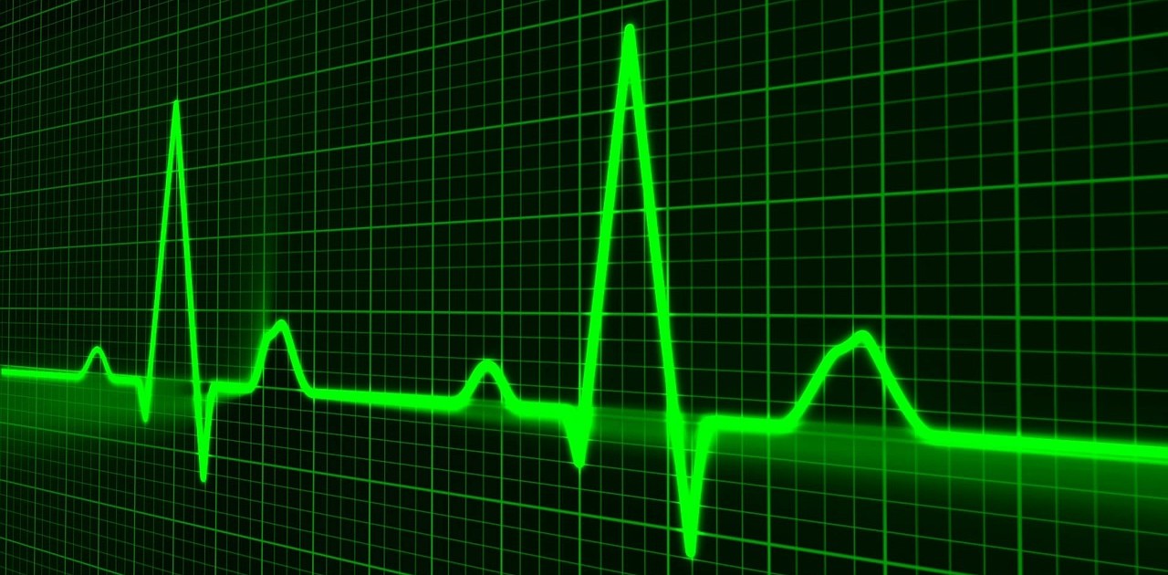 pulse-trace-163708_1280